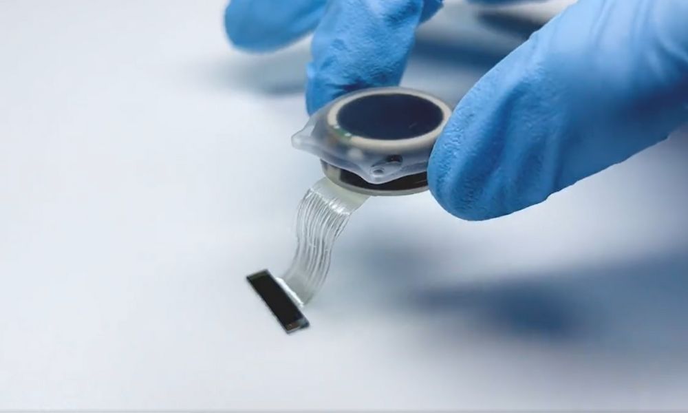 Neuralink electrode malfunction