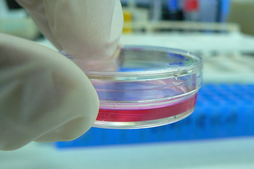 Stemcentrx, backed by Peter Thiel, raises $250 million