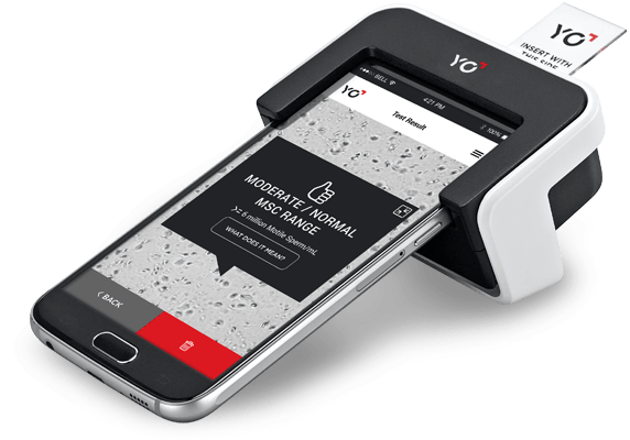 YO Sperm Kit helps a Man Test his Fertility in the Confines of his Home